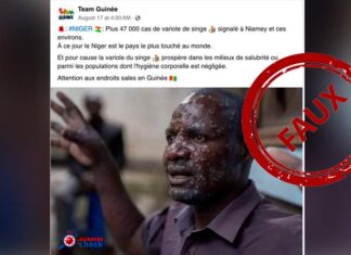 FAUX : Aucun cas de Mpox n’a été signalé au Niger