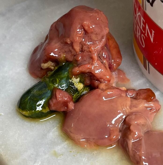bile-de-poulet
